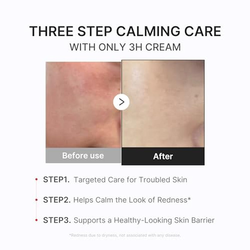 Calming & Barrier Comfort Duo: 3H Daily Relief Cream and Hypochlorous Acid Power Soothing Spray | Daily Soothing & Post-Care Hydration Routine