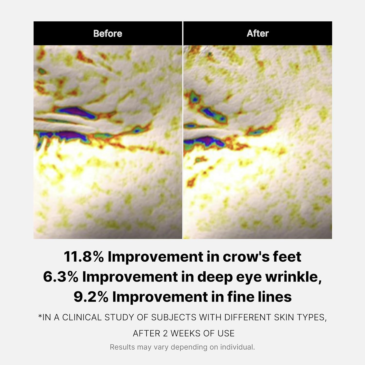 Eye Serum with Deep Reviving Peptide | Eye Treatment Serum with Multi Peptides, Niacinamide & Squalane | Reduces Signs of Aging and Fine Lines | Korean Skincare, 1.01 Fl.Oz